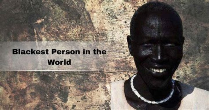Who is the blackest person in the world and where are they from?