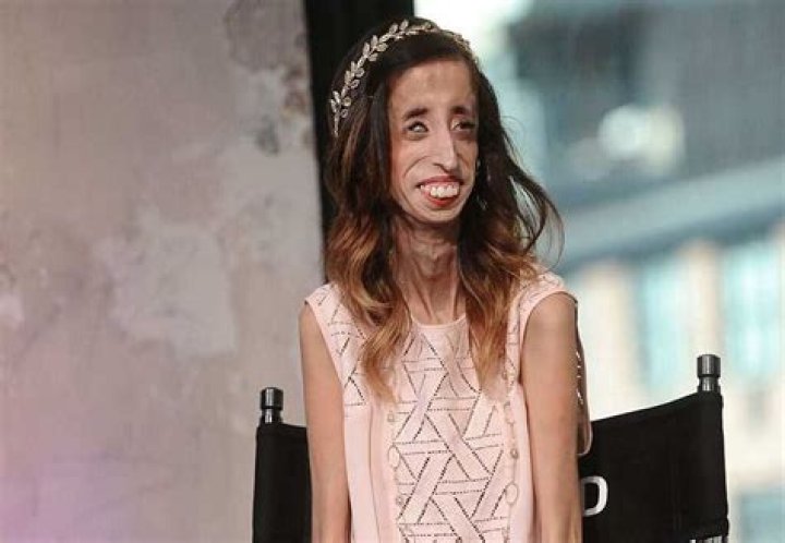 Who is the ugliest person in the world? Top 9 people with pictures