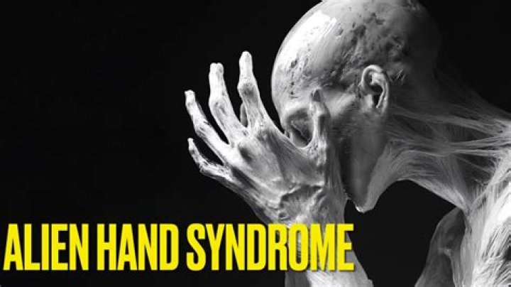 Alien Hand Syndrome Types, Cause & Representation In Movies And TV Shows