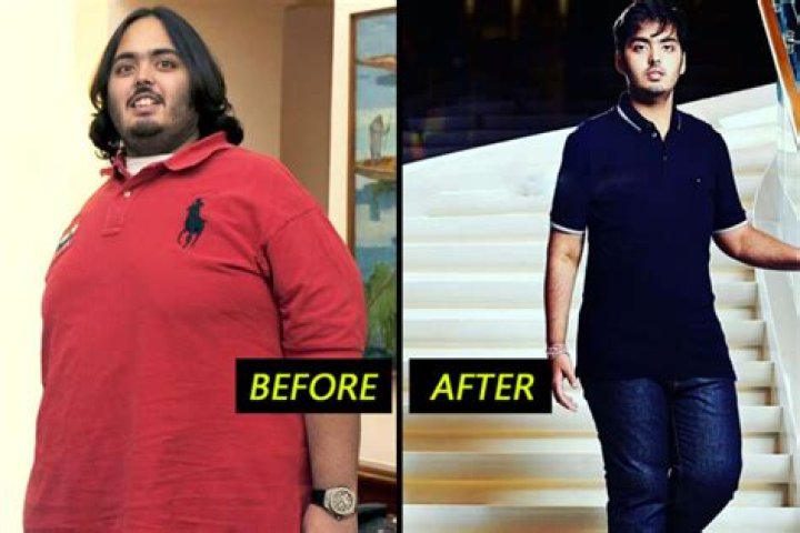 Anant Ambani Illness And Health Update: Weight Loss