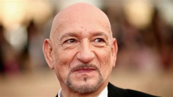 Is Ben kingsley Bald Now, What Happened To His Hair? Health Update