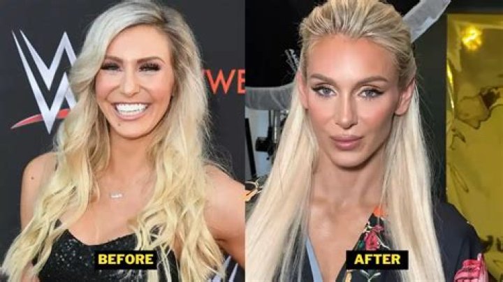 Did Charlotte Flair Undergo Plastic Surgery for WWE?