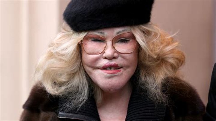 Esther Rantzen Plastic Surgery Before And After: Death Hoax