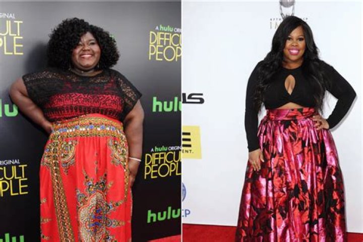 ‘Precious’ Actress Gabourey Sidibe Opens up about Weight Loss Surgery