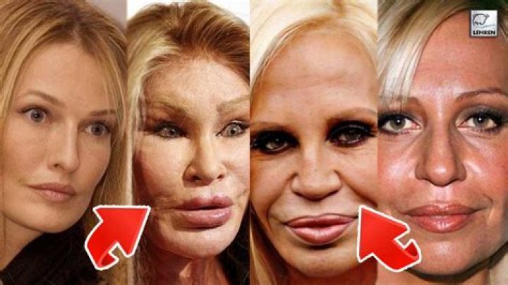 Has Marijana Veljovic Got Botox? Plastic Surgery Before And After