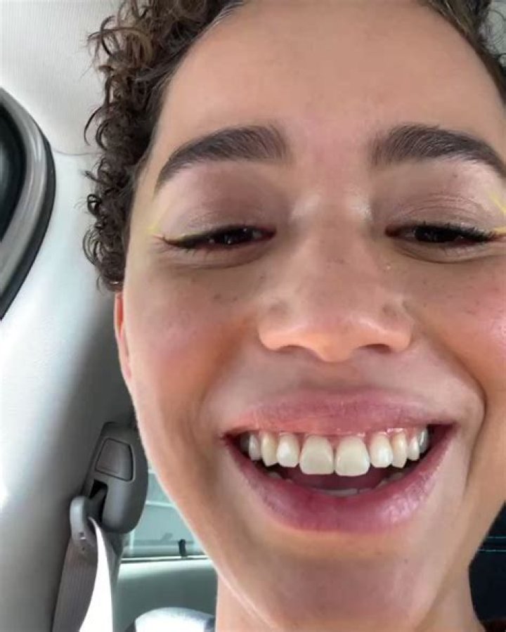 Has She Used Braces And Whitening?