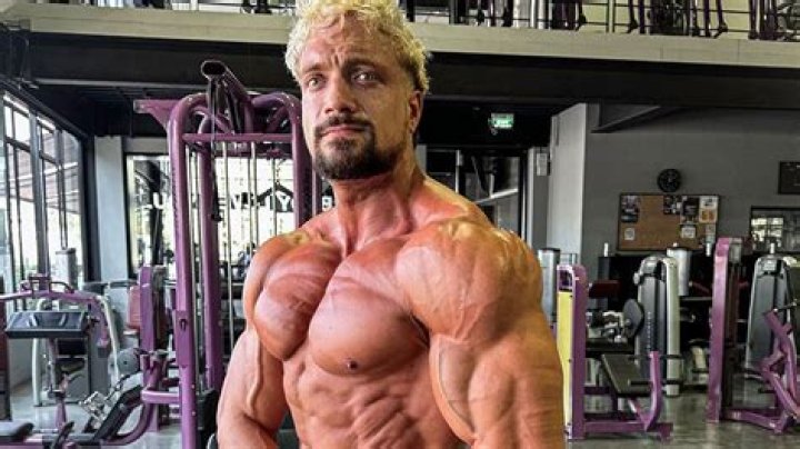 German Bodybuilder Died Of Aneurysm Disease