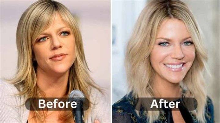 Like a Boss — Kaitlin Olson’s Response to Plastic Surgery Rumors