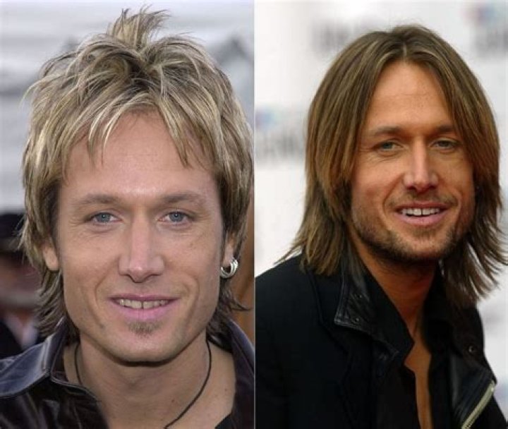 Has Keith Urban Had Plastic Surgery? Here's What The Twitterati Think