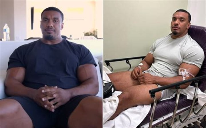 Strongman Larry Wheels continues to push through his injuries to achieve career and personal best