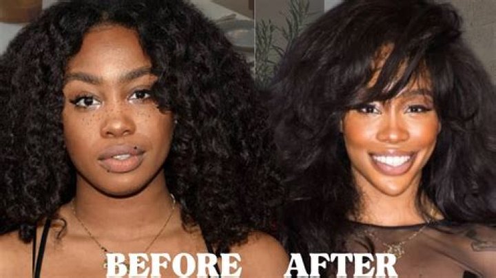 LightSkinKeisha Before Surgery Photos: How Did She Look Previously?