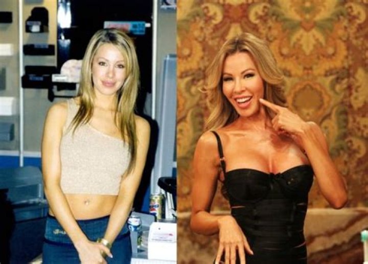 Lisa Hochstein Is Removing Facial Fillers after Going ‘Overboard’ Years Back