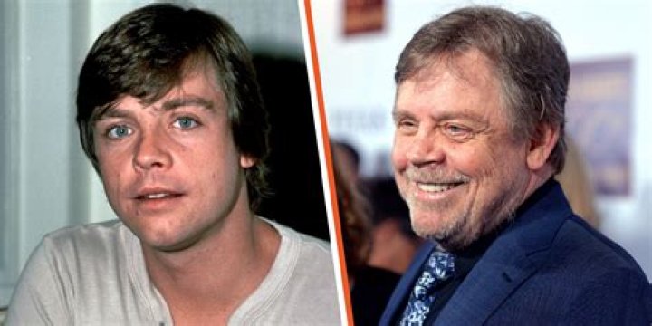 Mark Hamill Face Surgery: Accident And Health 2023