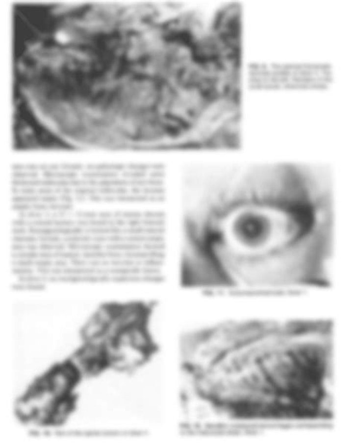 Nancy Ezhaya Accident Linked to Death Cause: Obituary