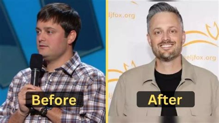 Nate Bargatze Weight Loss Journey: Before And After Photo