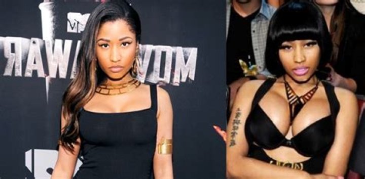 The Man Who Inspired Nicki Minaj to Get Plastic Surgery — Her before Surgery and after Pictures