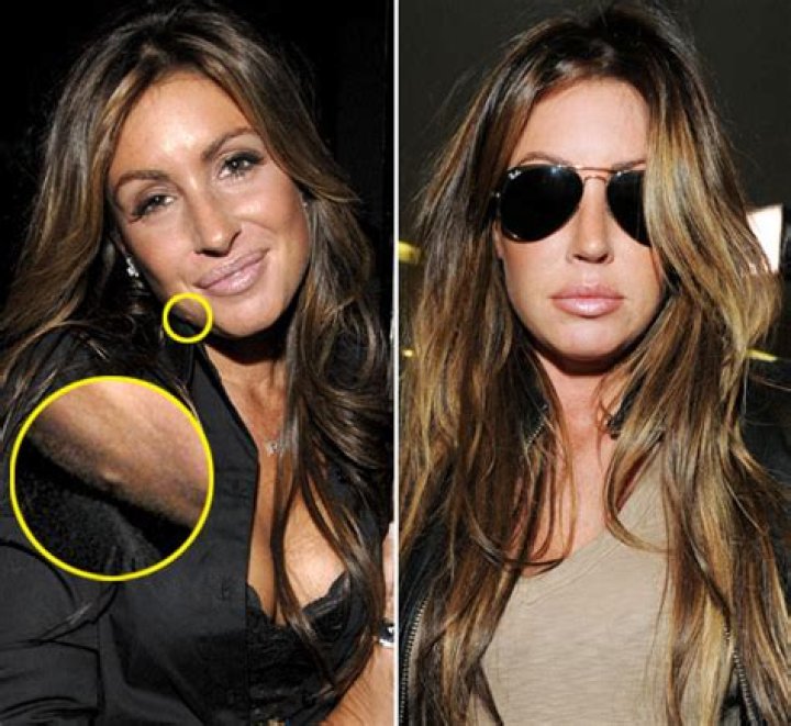 Did Rachel Uchitel Have Plastic Surgery? Where Is She Now?