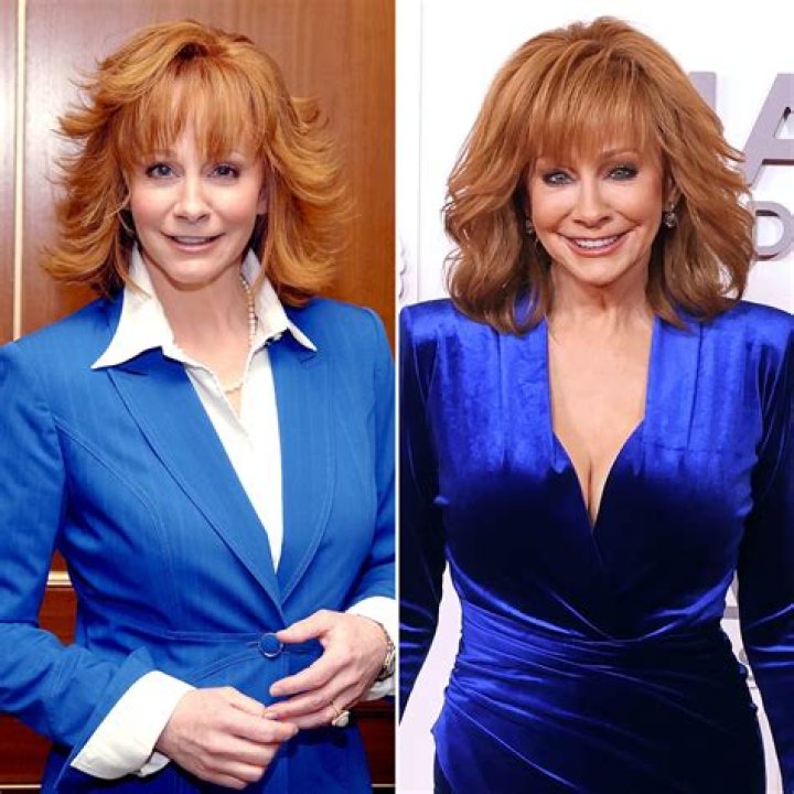 Has Reba McEntire Had Plastic Surgery? She Says No, the Internet Says Yes