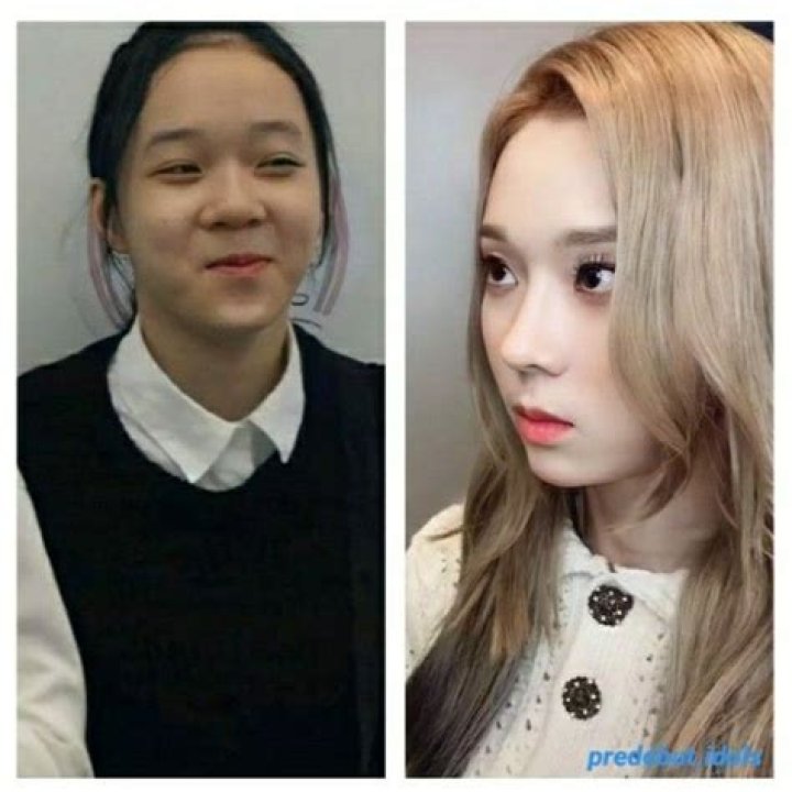 Winter AESPA Before Plastic Surgery: Did She Have Nose Job?